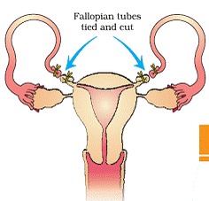 Reproductive Health class 12 Notes Biology